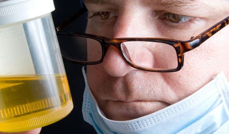 prostatitis kronikorako gernuaren azterketa